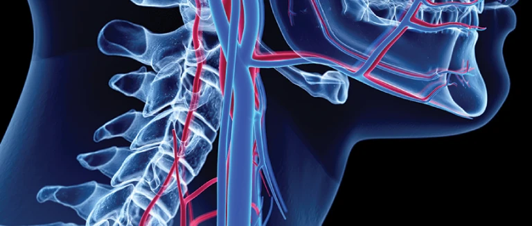 Carotid Artery: 5 Risks You Must Know 2 Carotid Artery