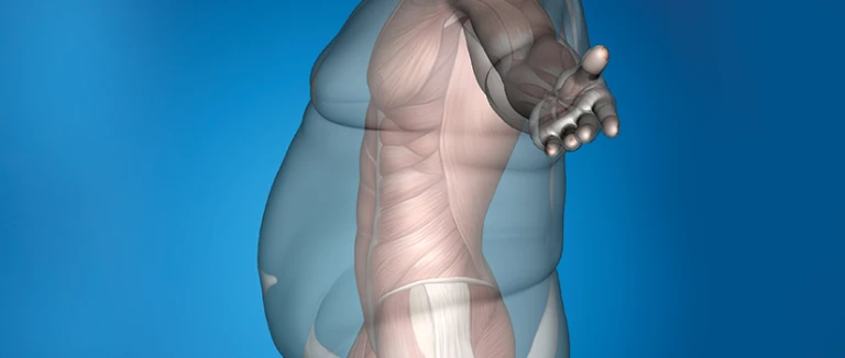 Rebirth with Obesity Surgery: 7 Benefits 1 Rebirth with Obesity Surgery