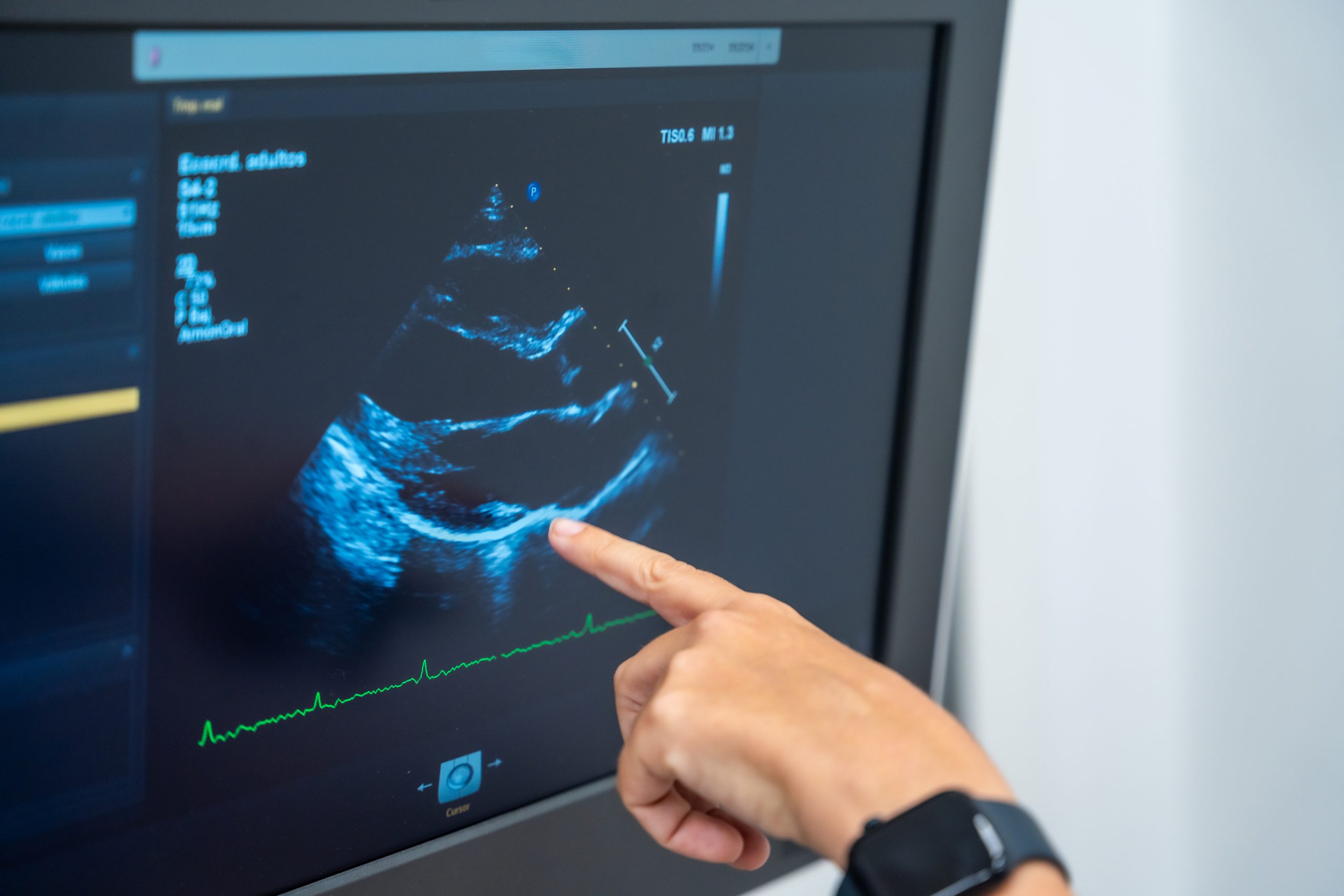 Abnormalities Can Be Found on the Echocardiogram
