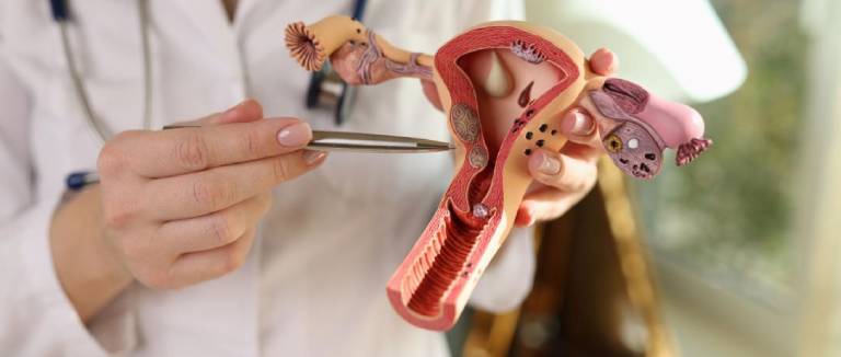 Myoma Surgery: Comfortable Recovery Guide 2 Myoma Surgery