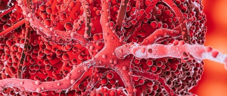 Acute Myeloid Leukemia: 5 Powerful Facts 1 Acute Myeloid Leukemia