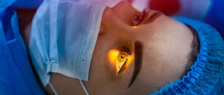 Femto Cataract Laser