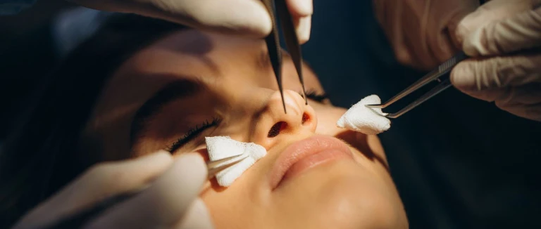 Nose Surgery -Rhinoplasty- 