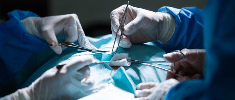 Kidney Transplantation: 5 Powerful Tips 2 Kidney Transplantation