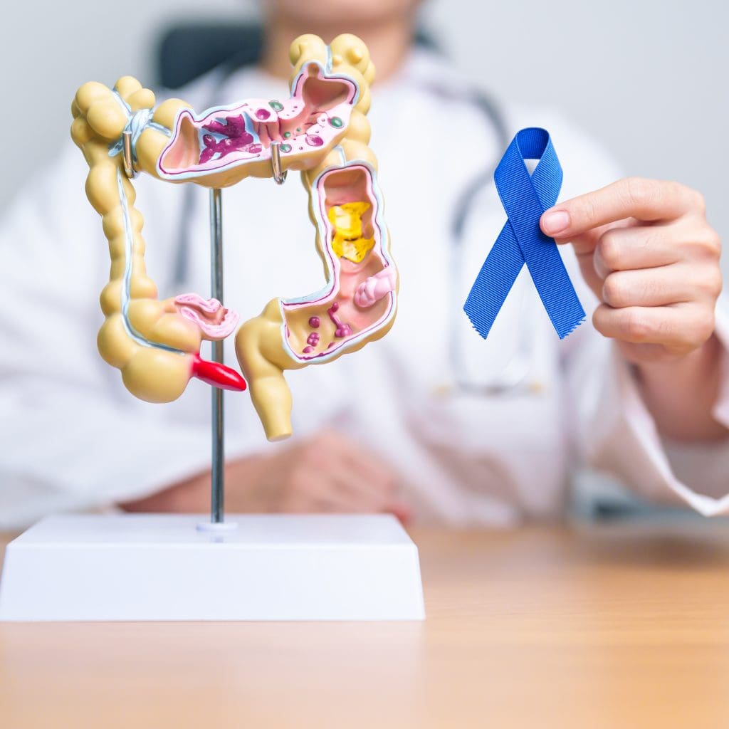 Does Colon Cancer Hurt?  