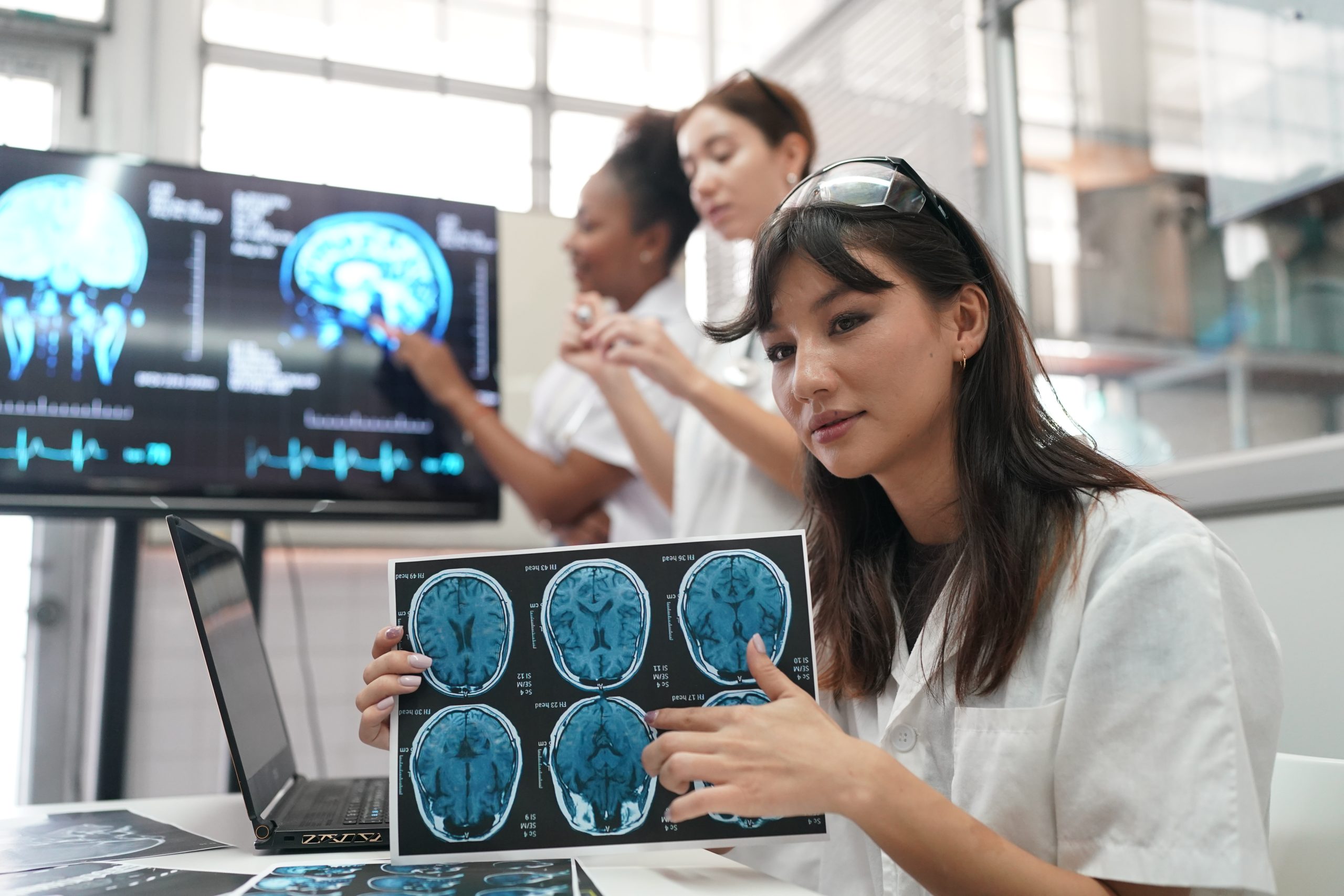 SPECT brain scan worth it