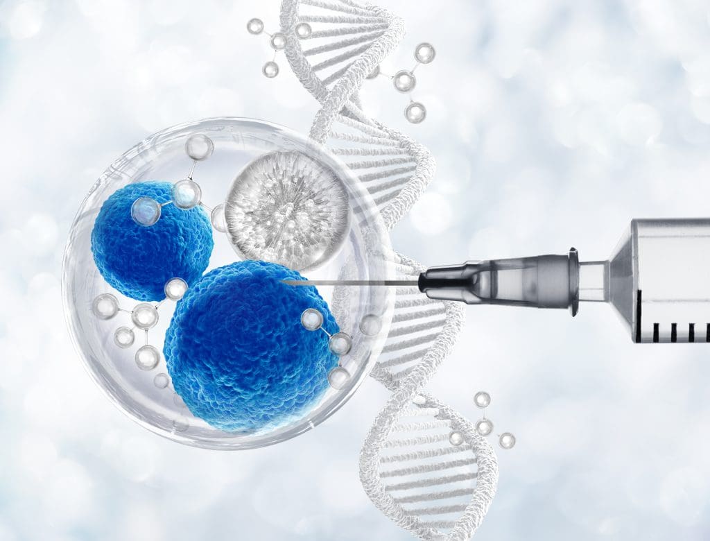 What is the most successful stem cell therapy? 1 growth factor stem cell 5 LIV Hospital
