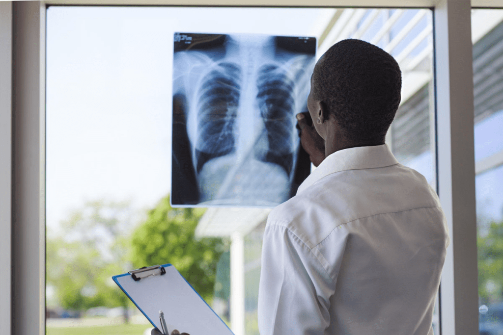 PET Scan Lung Nodule Cancer Detection: Accuracy and Test Guidelines