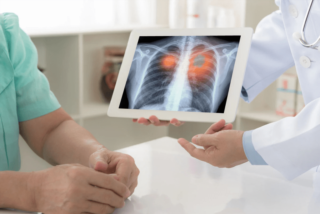 PET Scan Lung Nodule Cancer Detection: Accuracy and Test Guidelines