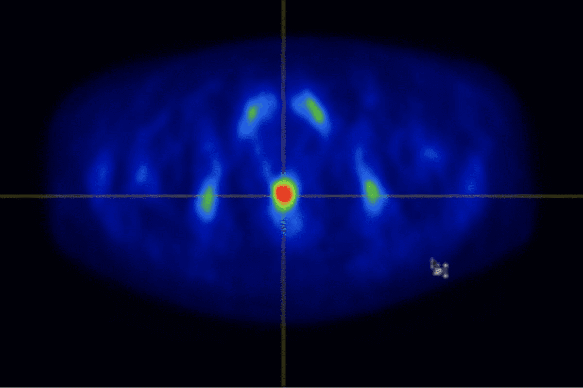 What Problems Can a PET Scan Detect? Powerful Overview