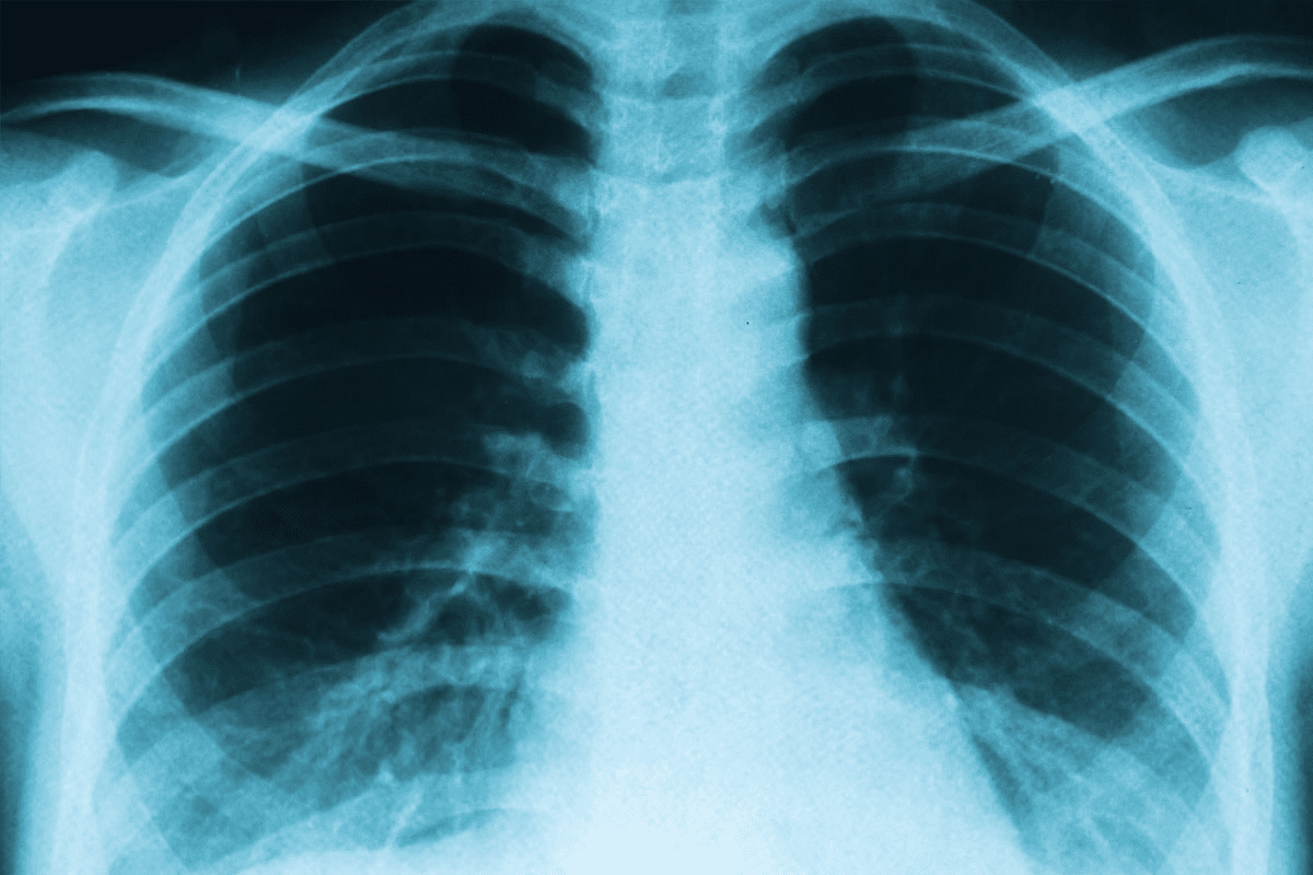 Why Doctor Recommend PET Scan: Medical Reasons and Diagnostic Benefits