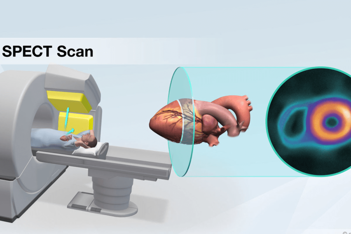 SPECT Scan Disadvantages: Important Limits and Powerful Facts