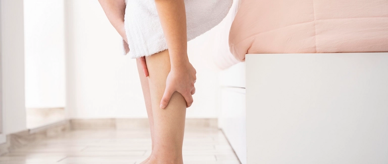 Comfortable Guide to Varicose Veins 2 Varicose Veins