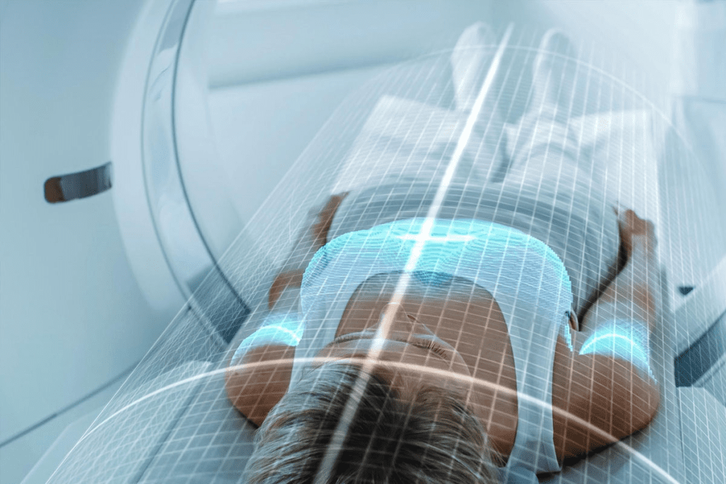 SPECT Scan Purpose: Powerful Tool for Organ Function Assessment