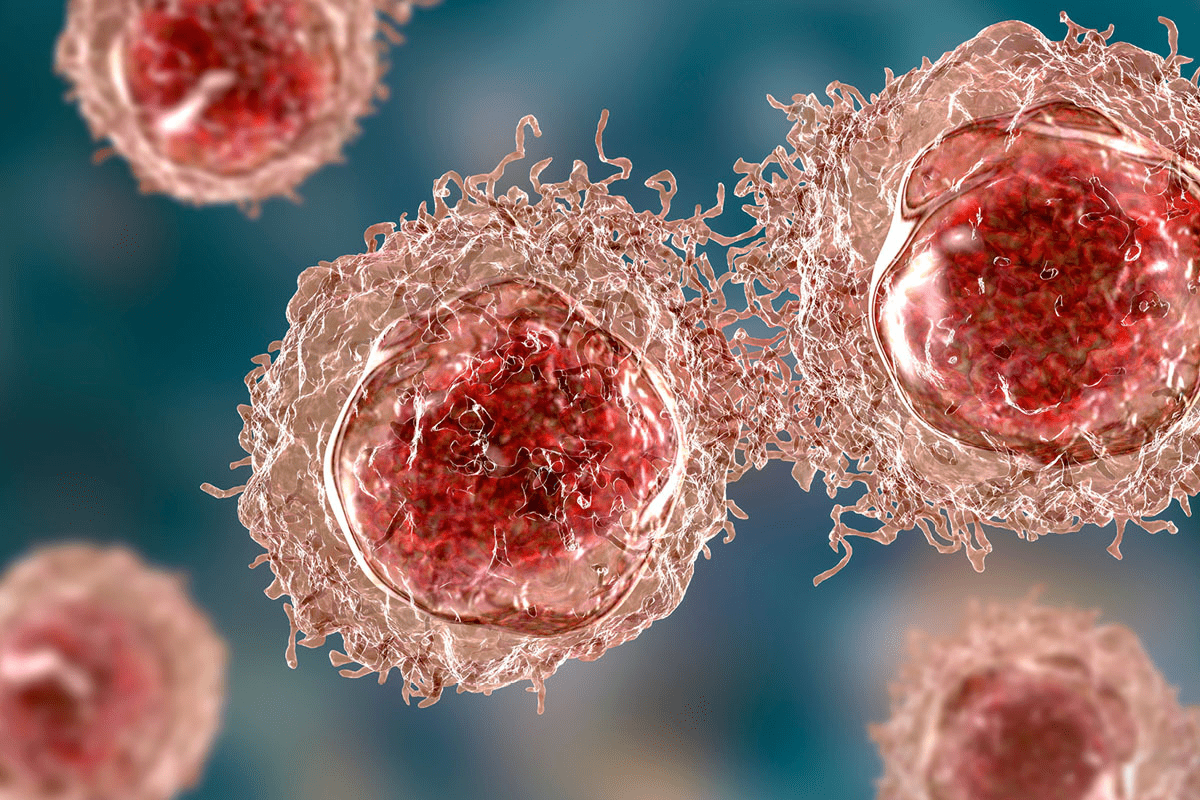 Is Low Hemoglobin One of the 5 Main Lymphoma Symptoms?