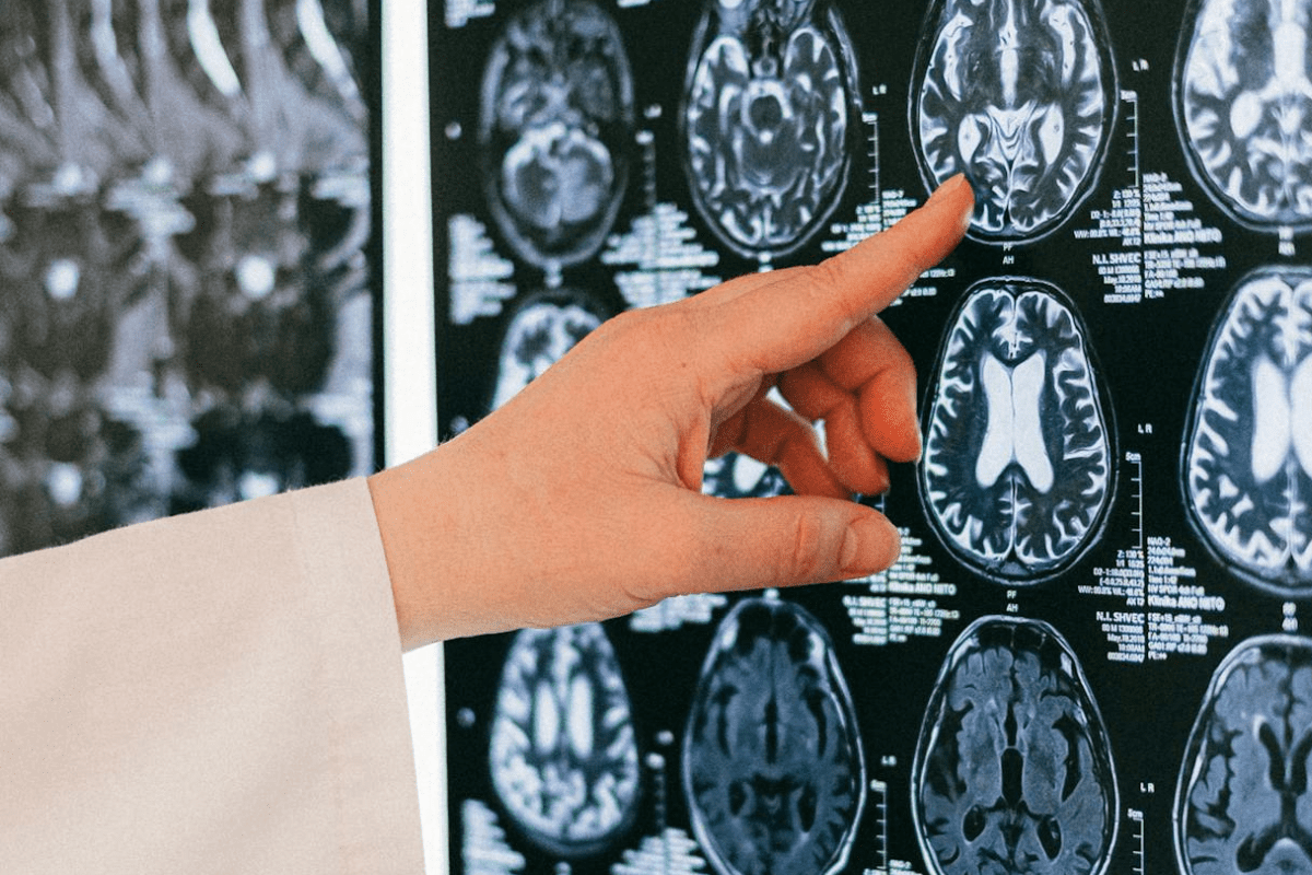 Stem Cell Transplant: Understanding the Procedure and Process