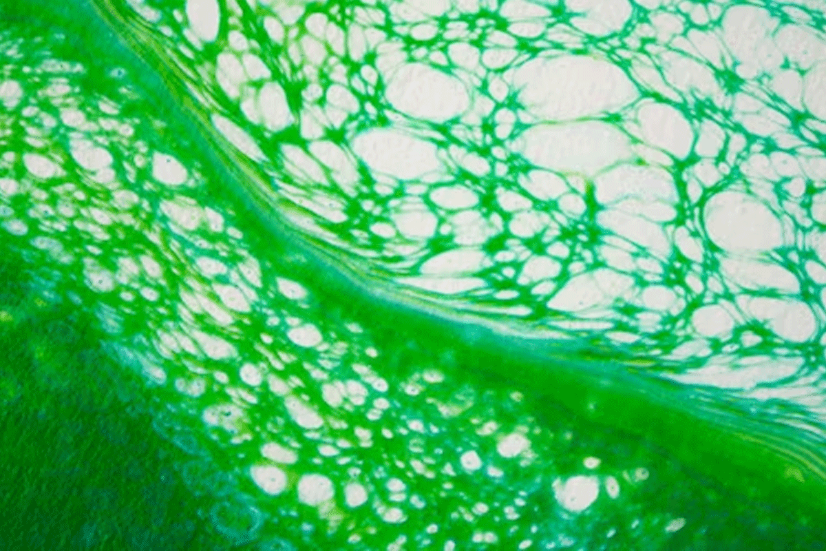 Stem Cell Patches Side Effects: What You Need to Know