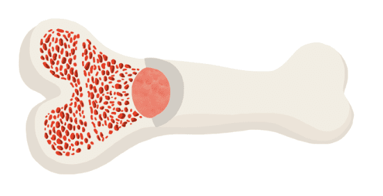 Understanding Adult Multipotent Stromal Cells: Key Properties and Roles