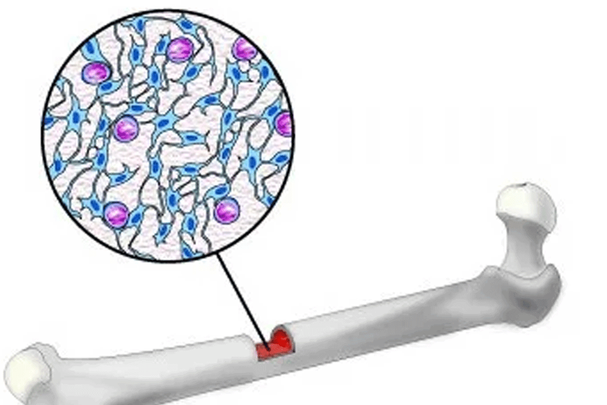 Powerful Insights into Adult Multipotent Stromal Cells