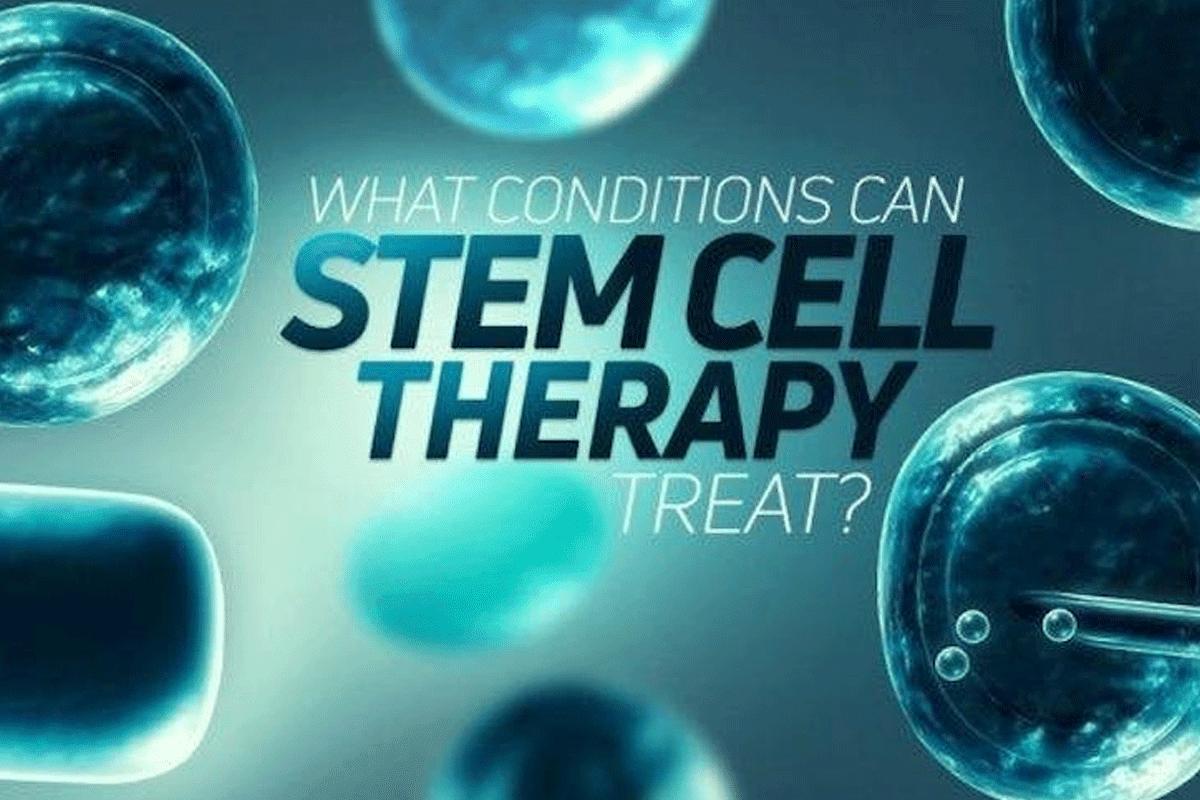 Stem Cell Therapy Success Rate: Facts & Patient Outcomes