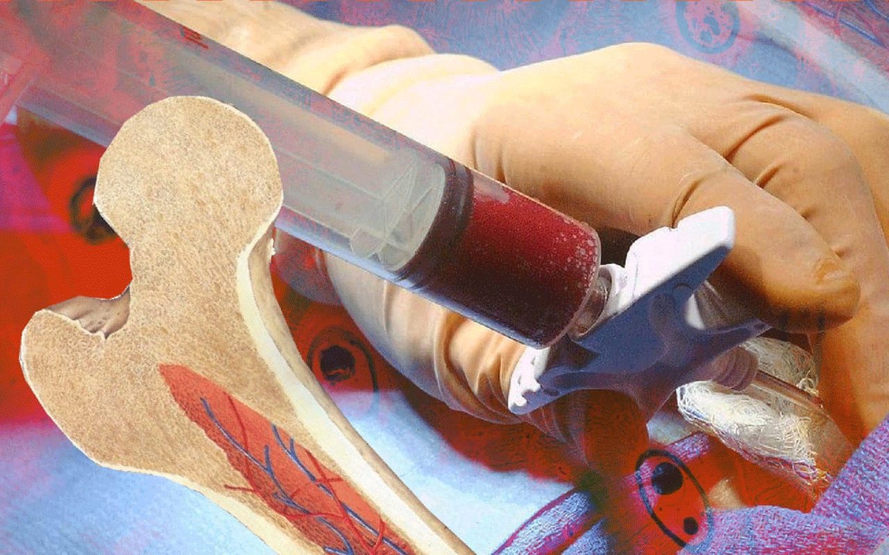 Understanding Stem Cell DNA and Bone Marrow Transplants