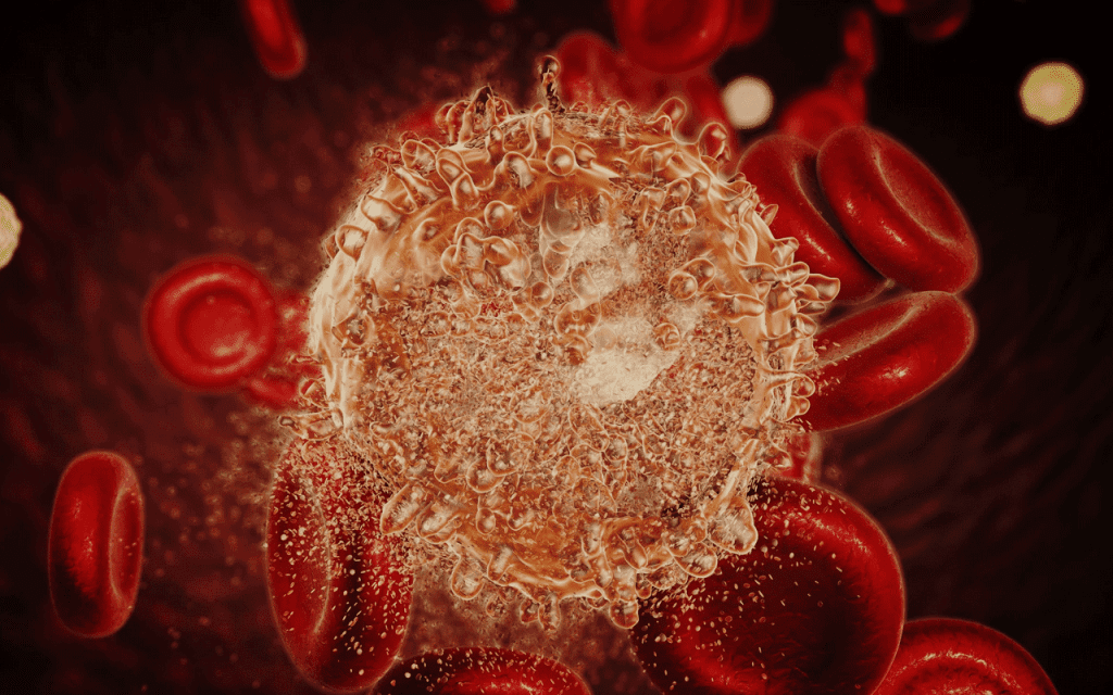 Leukemia Survival Rate: Hopeful Advances for 2025 1 Leukemia Survival Rate: Hopeful Advances for 2025