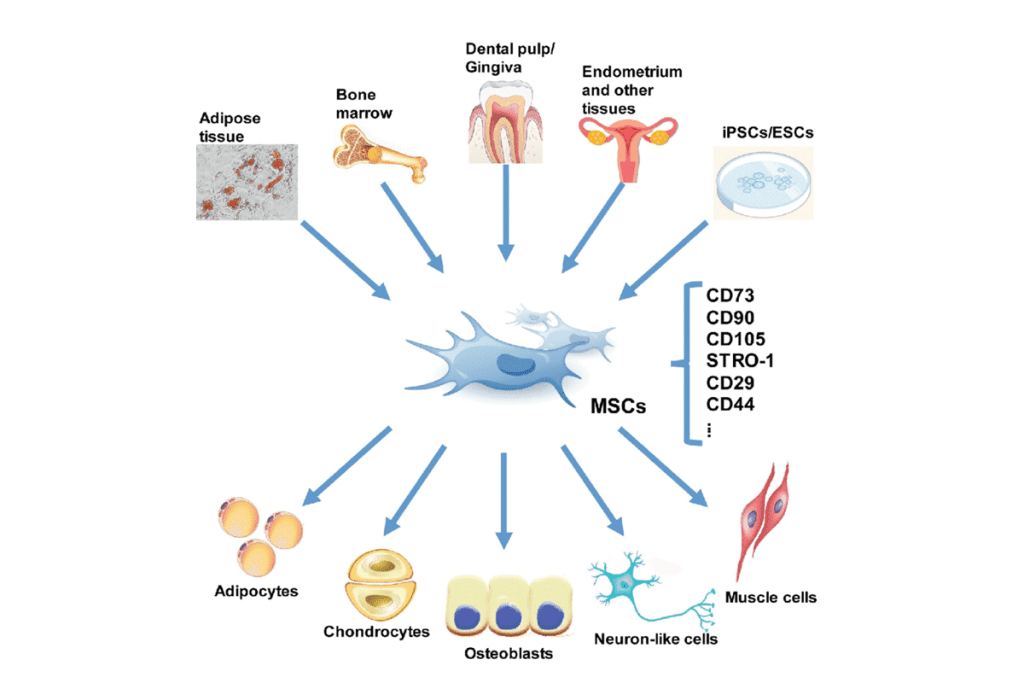 Understanding Mesenchymal Stem Cells Controversy and Stem Cell Therapy Side Effects 3 Understanding Mesenchymal Stem Cells Controversy and Stem Cell Therapy Side Effects