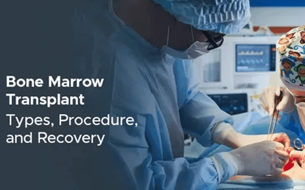 Bone Marrow Transplant Pain: Shocking Truth & Relief Guide