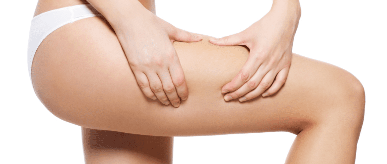 7 Essential Cellulitis Facts You Must Know 2 Cellulitis