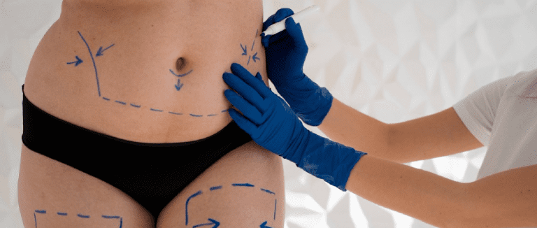 5 Effective Weight Loss Surgery Options 2 Weight Loss Surgery