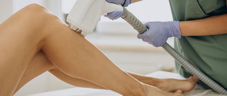 Laser Hair Removal for Smooth, Lasting Skin 2 Laser Hair Removal