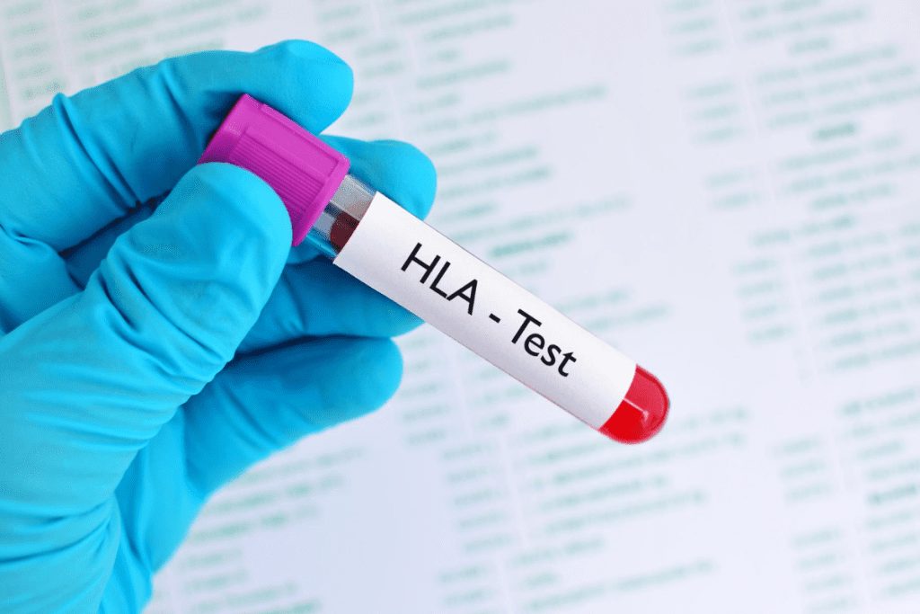 Stem Cell Donation Procedure: What to Expect & Steps Explained