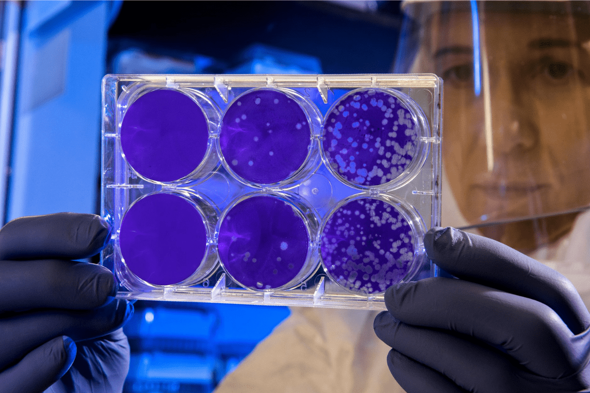 Non-Invasive Stem Cell Collection: Remarkable Breakthrough Benefits