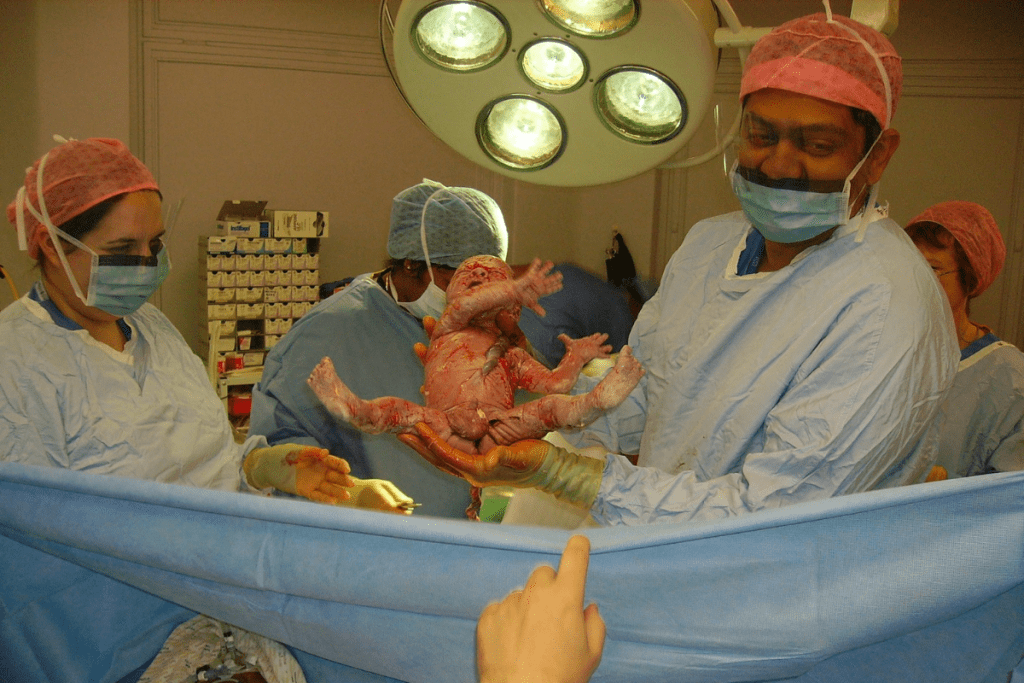 Non-Invasive Stem Cell Collection: Remarkable Breakthrough Benefits