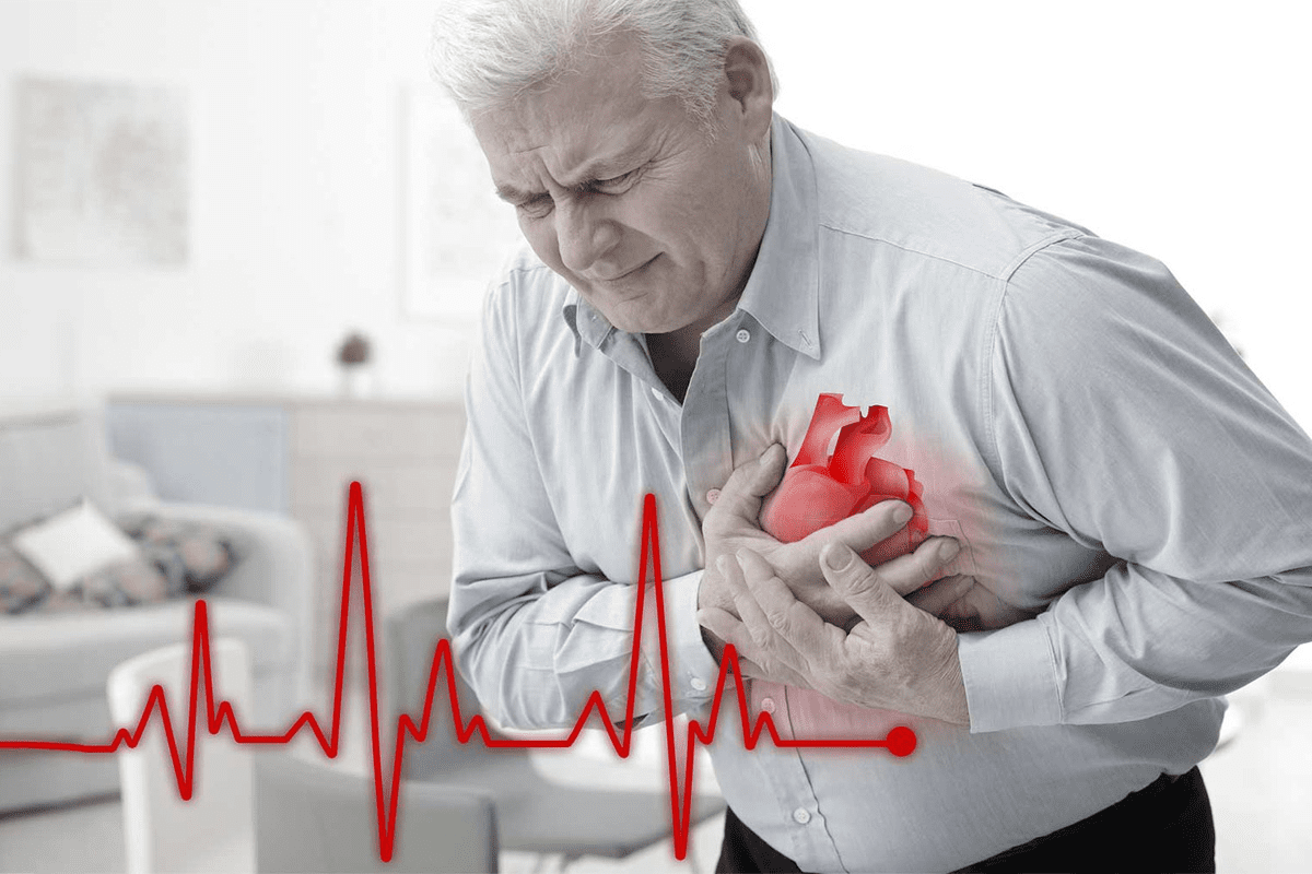 What to Expect During a Nuclear Stress Test for Heart Health Evaluation