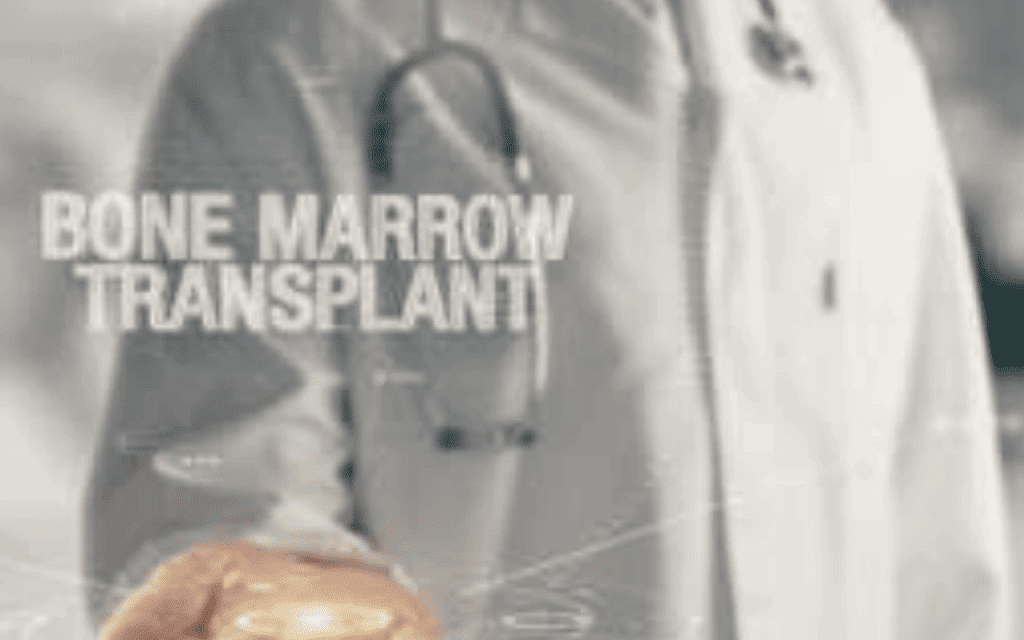 Blood Transplant Side Effects: Powerful Risks and Important Facts 1 Blood Transplant Side Effects: Powerful Risks and Important Facts