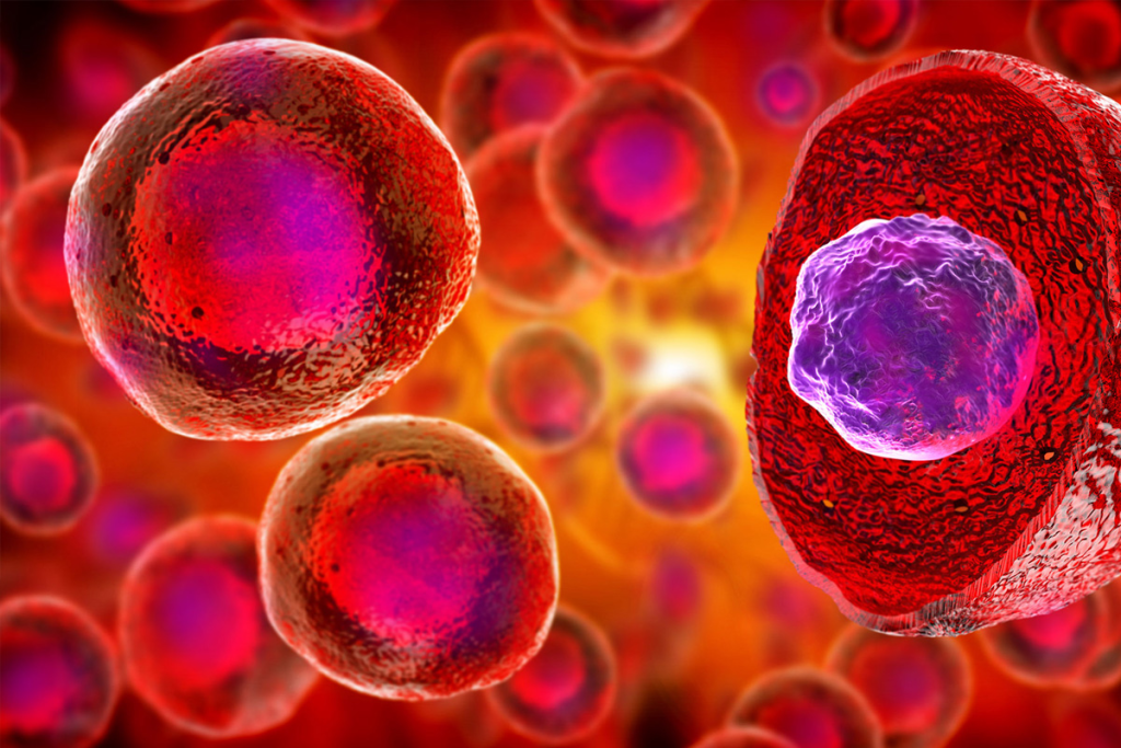 Stem Cell Therapy for Back Pain: Effective Relief Solution