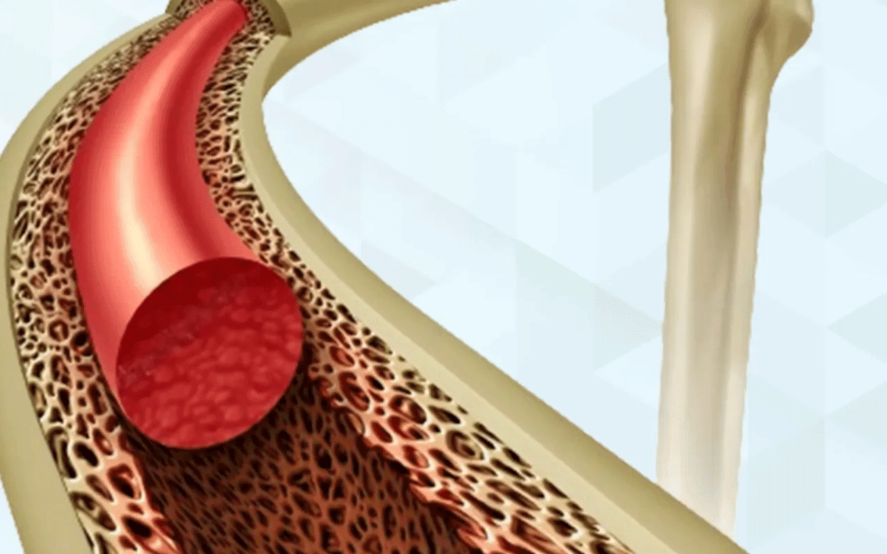 BM Transplantation: Powerful Healing with Advanced Stem Cell Therapy