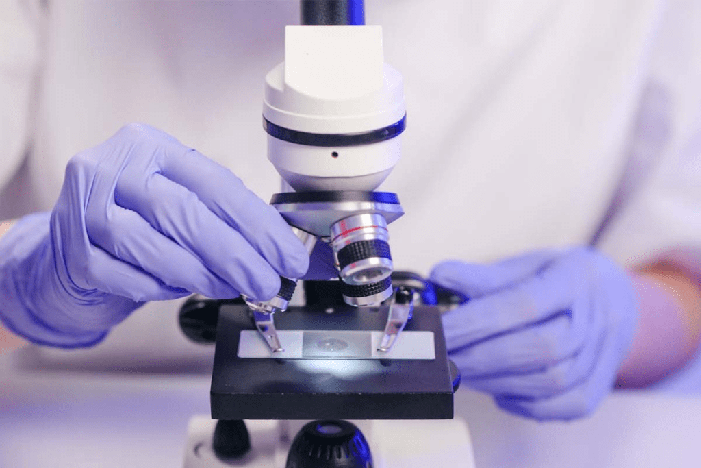 Stem Cell Therapy: Breakthrough Healing for Leukemia Patients 3 Stem Cell Therapy: Breakthrough Healing for Leukemia Patients