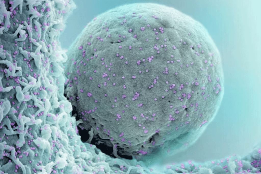 Mesenchymal Stem Cells Treatment: Revolutionary Healing Option 2 Mesenchymal Stem Cells Treatment: Revolutionary Healing Option