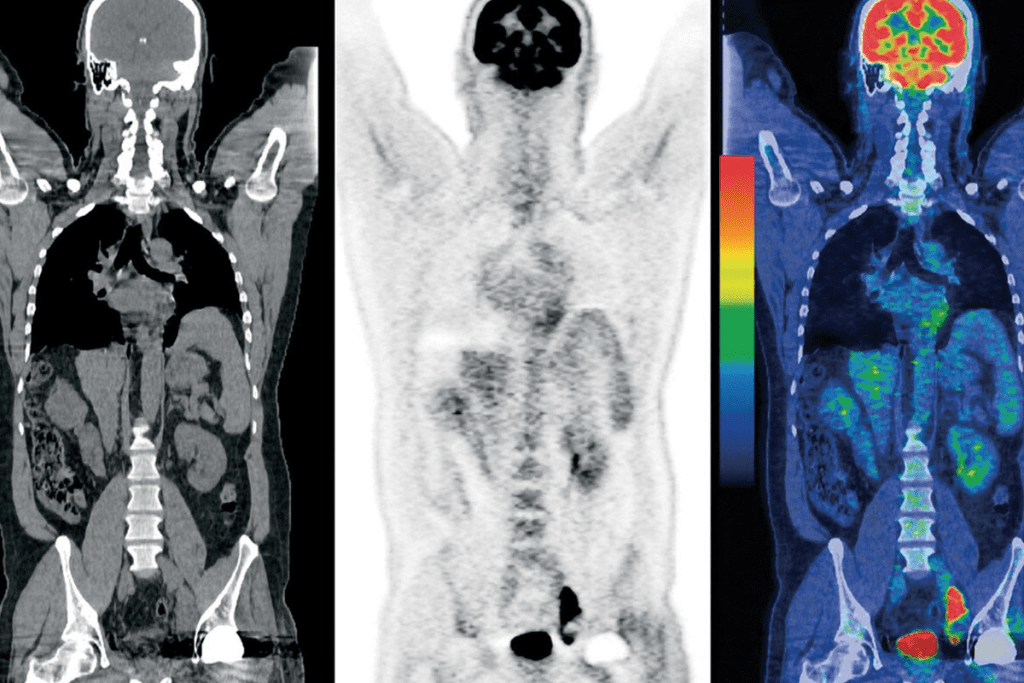 Nuclear Stress Test Cost: Powerful Insight on Pricing Factors