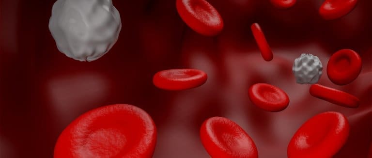 Myelodysplastic Syndromes: New Hope 2 Myelodysplastic syndromes