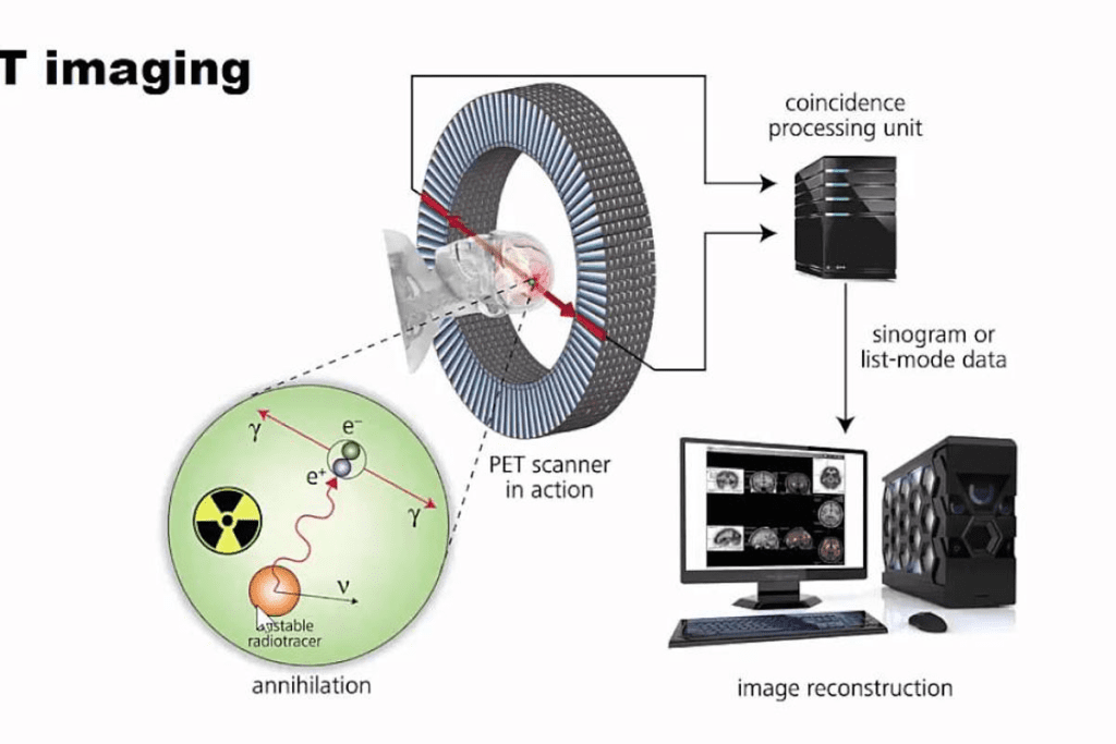 Hours Radioactive After PET Scan “ Complete Safety Guide