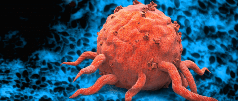 Acute Myeloid Leukemia: 5 Powerful Facts 3 Acute Myeloid Leukemia