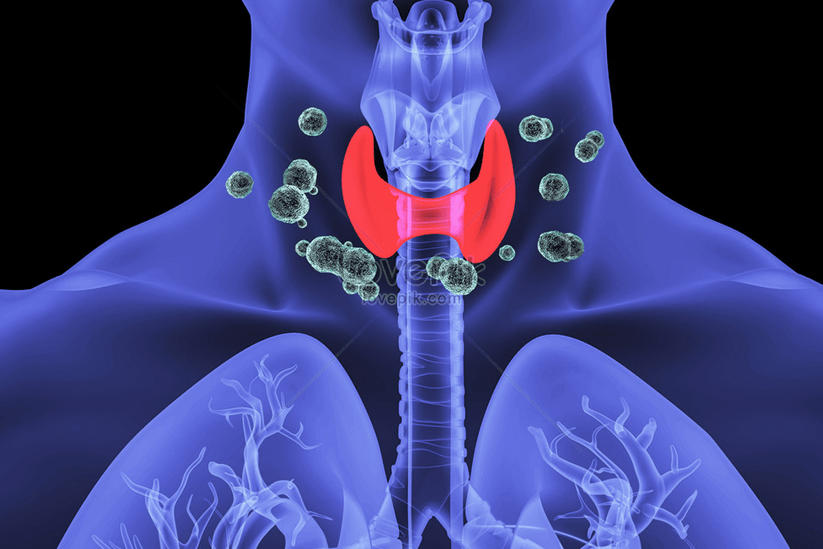 Lymphoma Early Signs: Powerful Awareness for Timely Detection