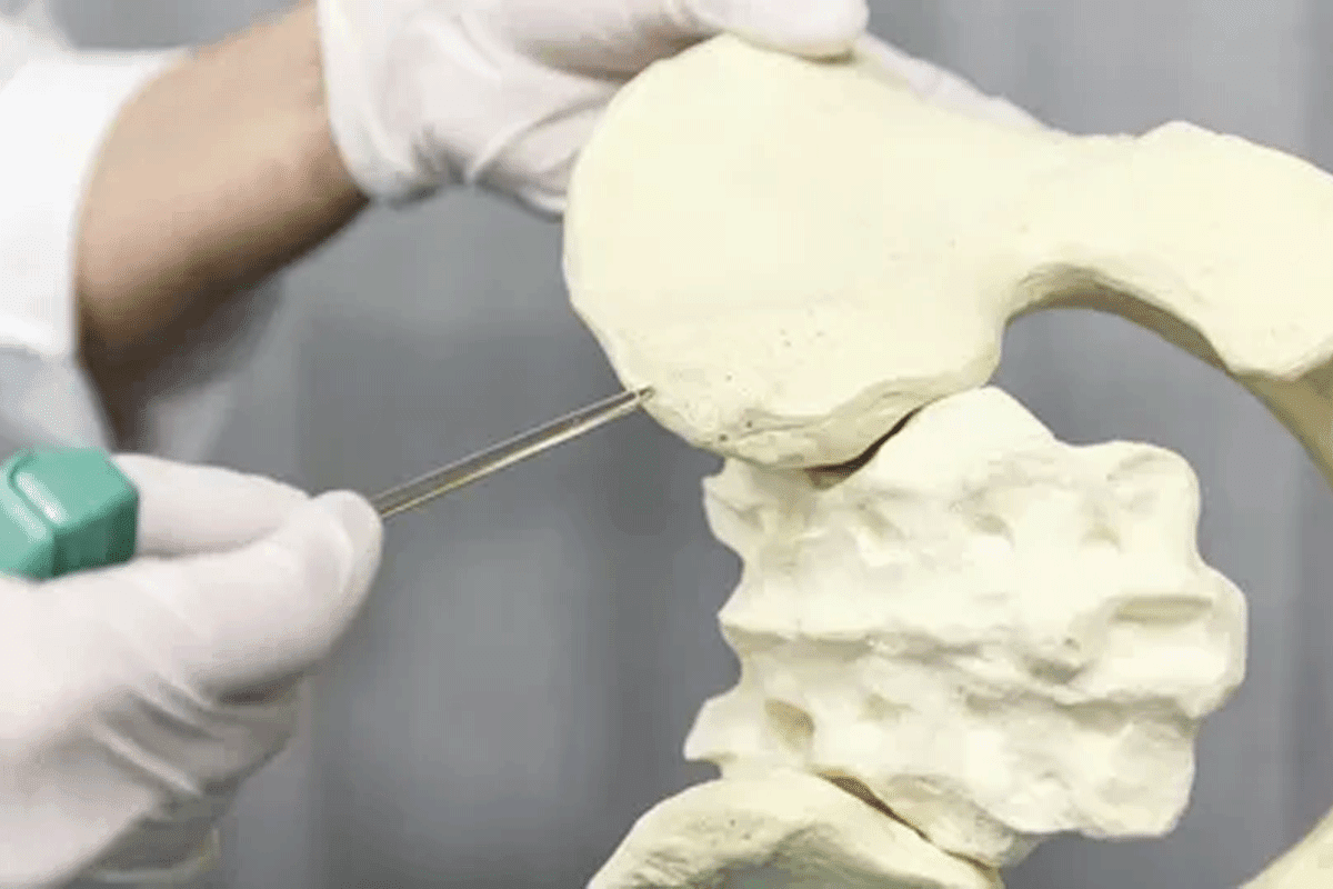 Â Why Can Only Males Donate Bone Marrow? Understanding How to Donate Bone Marrow