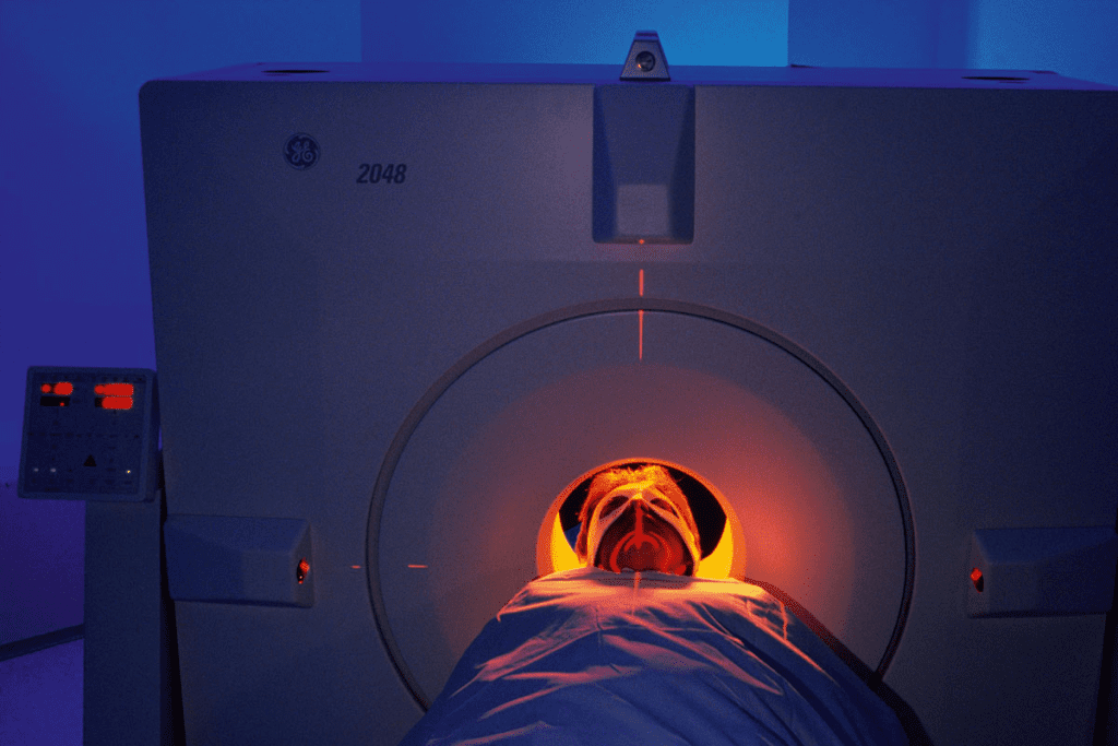 Scar Tissue PET: Powerful Imaging to Differentiate Scar and Disease 2 Scar Tissue PET: Powerful Imaging to Differentiate Scar and Disease