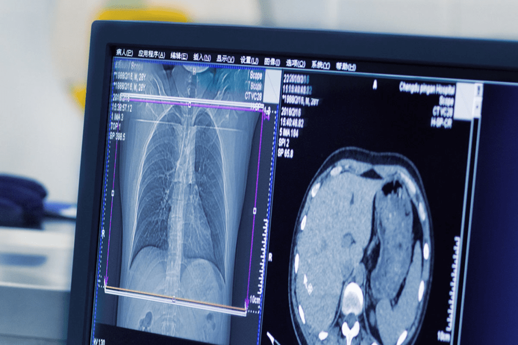 High-Resolution CT: Advanced Imaging for Detailed Lung and Tissue Views