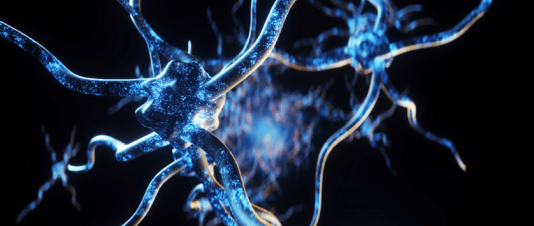 7 Facts About Brain Aneurysm 2 Brain Aneurysm