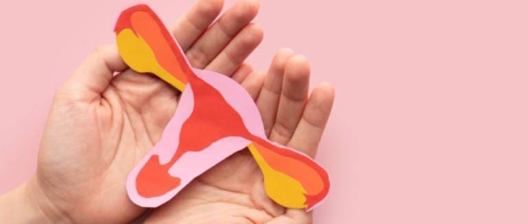 Pelvic Congestion Syndrome Treatment 2 Pelvic Congestion Syndrome